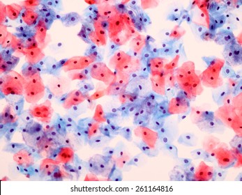 Pathology Images Stock Photos Vectors Shutterstock - 