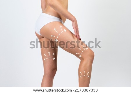 Cellulite removal on body and legs woman. Young girl with beautiful and healthy body concept.