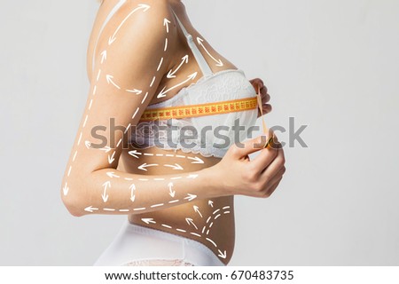 Cellulite removal scheme body. White markings arrow young woman meter. Cosmetic breast surgery