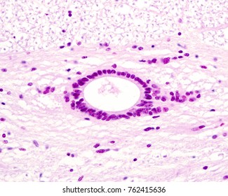 Central Or Ependymal Canal Of The Spinal Cord Lined By Ependymal Cells, Which Appear As A Simple Columnar Epithelium.

