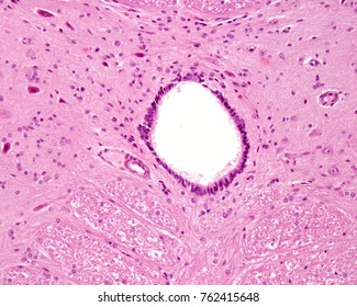 Central Or Ependymal Canal Of The Spinal Cord Lined By Ependymal Cells, Which Appear As A Simple Columnar Epithelium.