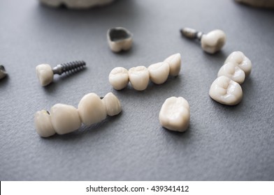 Ceramic dentures and crowns on gray background. Top view on set of single dentures and dental crowns. Tooth repair equipment on gray background.