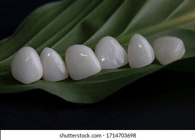 Ceramic  Porcelain Veneers  Close-up, New Smile White Teeth