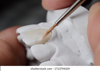 Ceramic powder baking procedure of fabricating porcelain laminated veneer. Ceramic dental veneer to correct tooth color. - Shutterstock ID 1713794329