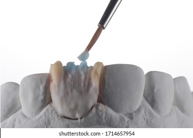 Ceramic Powder Baking Procedure Of Fabricating All Ceramic Dental Crown With Layering Technique. Ceramic Dental Veneer To Correct Tooth Color. Close Up Dental Photography White Background.