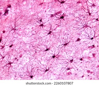 Cerebral cortex, light micrograph. Protoplasmic astrocytes of the grey matter. The astrocytes show many processes and endfeet polarized towards a blood vessel. Cajal's gold sublimate technique