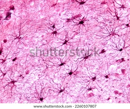 Cerebral cortex, light micrograph. Protoplasmic astrocytes of the grey matter. The astrocytes show many processes and endfeet polarized towards a blood vessel. Cajal's gold sublimate technique
