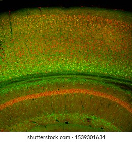 Cerebral cortex and part of the hippocampus under it in a section of a mouse brain, labelled with immunofluorescence and recorded with confocal laser scanning microscopy
