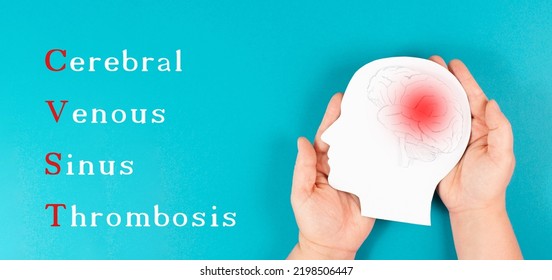 Cerebral Venous Sinus Thrombosis Is Standing On The Background, Silhouette Of A Head With A Brain, Red Blood Clot, Side Effect Covid-19 Vaccine