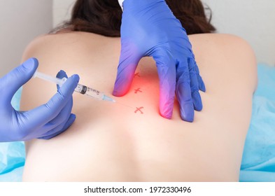 Cerebrospinal injection with ozone to relieve pain and inflammation in the back. Treatment of osteochondrosis and arthrosis of the spine with blockade therapy, chondroprotector - Shutterstock ID 1972330496
