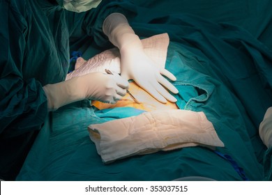 Cesarean In Operation Room