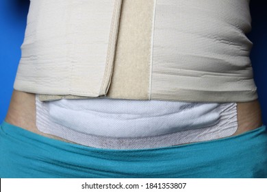 Cesarean Section Bandage And Corset. Postpartum Rehabilitation