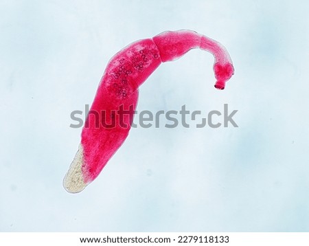Cestodes, Hydatid worm, Echinococcus granulosus     