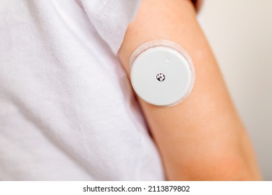 CGM -system Of Continuous Monitoring Of Glucose On Child's Arm.