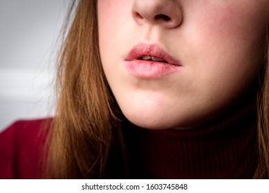 Chapped, Or Cracked, Dry Lips That Have Lost Moisture. Woman Maintains Her Lips. Lip Care.