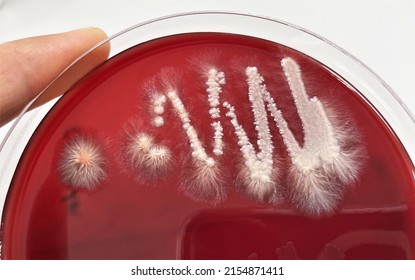 
The characteristic of Candida albicans fungal culture on blood agar plate,Colonies with filamentous hyphal growth form : White creamy colored, Foot-like extensions from the margin, in  close up.