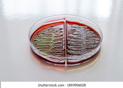 Characteristic mucoid colonies of Klebsiella pneumoniae on the agar plate.Blood agar plate with microorganisms.