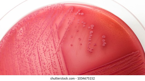 Characteristice Eschericia Coli On Macconkey Agar Stock Photo ...