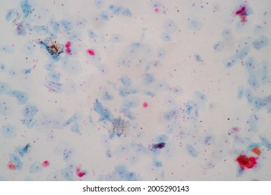 447 Nuclear human tissue Images, Stock Photos & Vectors | Shutterstock