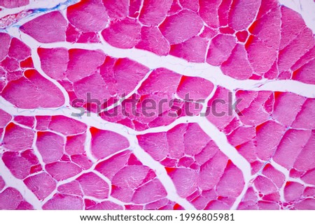 Characteristics of anatomy and Histological sample Striated (Skeletal) muscle of mammal Tissue under the microscope.

