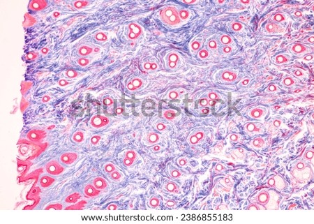 Characteristics Tissue of Human scalp, Skin human from general body surface and showing sweat glands under microscope.