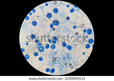 Characterization of aspergillus spp. under light microscope at 20x magnification after staining with Lactophenol cotton blue