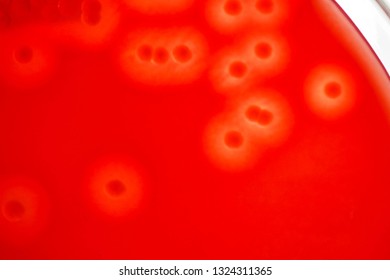 Charateristic Complete Hemolysis Bacterial Colonies On Stock Photo ...