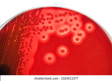 706 Hemolysis Images, Stock Photos & Vectors | Shutterstock