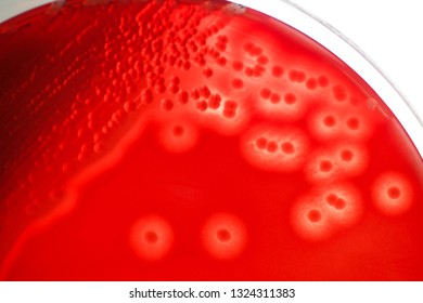 Charateristic Complete Hemolysis Bacterial Colonies On Stock Photo 