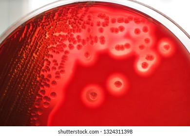 Hemolysis Images, Stock Photos & Vectors | Shutterstock