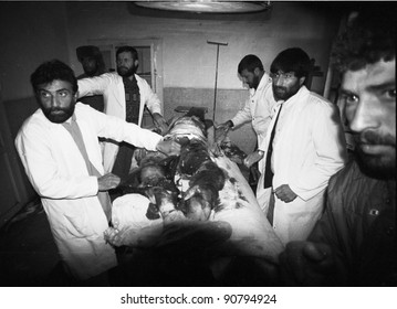 CHARIKAR, AFGHANISTAN - OCT 23: Doctors Prepare To Amputate The Bomb Shattered Leg Of A Northern Alliance Soldier In A Hospital In Charikar, Afghanistan, On Wednesday, October 23, 1996.