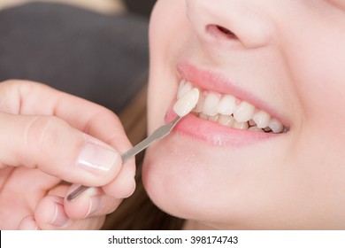 Check Veneer Of Tooth Crown In A Dental Laboratory