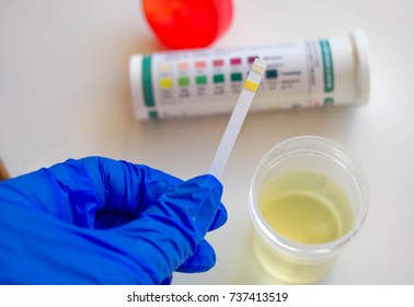 Urine Protein Images Stock Photos Vectors Shutterstock