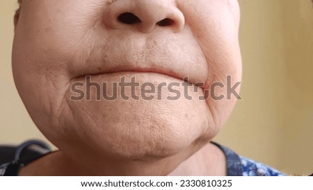 The cheeks of the elderly are wrinkled.