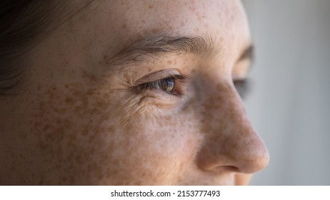 Cheerful freckled young woman looking away, smiling, laughing. Close up of upper face. Cropped shot of teenage girl with dry spotted facial skin. Skincare, natural beauty, eye care, vision concept