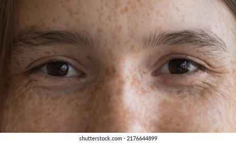 Cheerful freckled young woman looking at camera, upper cropped face view. Close up shot of happy optimistic female with spotted facial skin. Skincare, natural beauty, eye care, vision check up concept