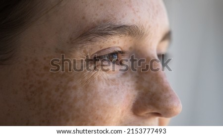 Cheerful freckled young woman looking away, smiling, laughing. Close up of upper face. Cropped shot of teenage girl with dry spotted facial skin. Skincare, natural beauty, eye care, vision concept