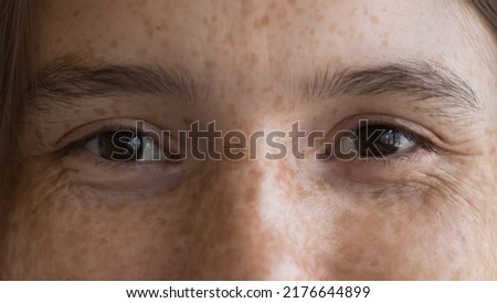 Cheerful freckled young woman looking at camera, upper cropped face view. Close up shot of happy optimistic female with spotted facial skin. Skincare, natural beauty, eye care, vision check up concept