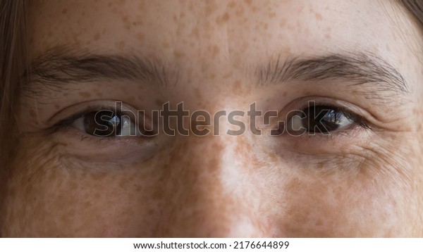Cheerful freckled young woman looking at camera,\
upper cropped face view. Close up shot of happy optimistic female\
with spotted facial skin. Skincare, natural beauty, eye care,\
vision check up\
concept
