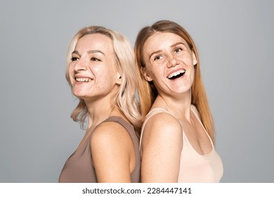 Cheerful women with skin issues standing back to back isolated on grey