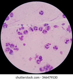 Chemical And Cellular Factors Involved In The Inflammatory Response To Tissue Damage And Repair.white Blood Cells Clumping.