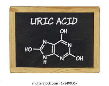 chemical formula of uric acid on a blackboard