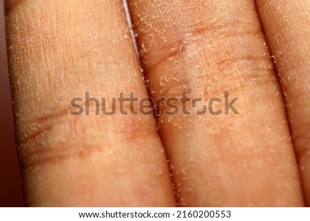 Similar – Image, Stock Photo Resilience, enduring pain, needles from a conifer stuck in your hand