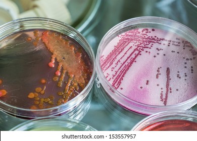 Chemistry process on a petri dish and bacterias