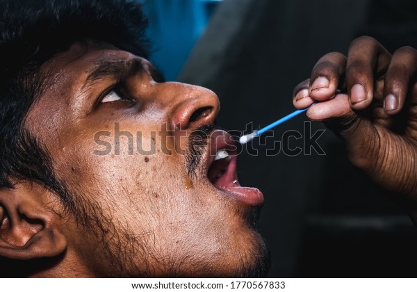 Chennai, India - July 2nd 2020 : Patient\
receiving a Corona test - Corona virus / Covid-19 testing carried\
out by Doctor - taking a mouth swab from a person to test for\
possible coronavirus\
infection