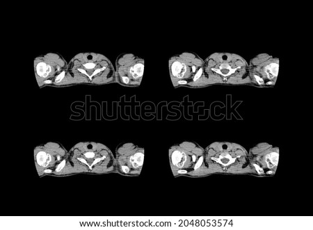 Chest ct scan and mri images