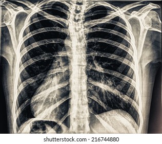 human chest Images, Stock Photos & Vectors | Shutterstock