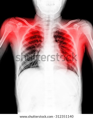 A chest x-ray image for a medical diagnosis.