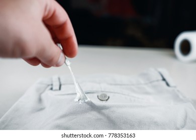 Chewing Gum Stuck To The Jeans Closeup, Removal Of Chewing Gum From Pants