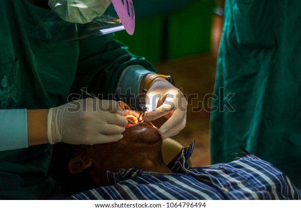 CHIANG RAI, THAILAND -\
MARCH 26 2018: Unidentified dentist volunteers from public hospital\
are in medical service at BanPaNaSaWan School in Chiang rai, North\
of Thailand.